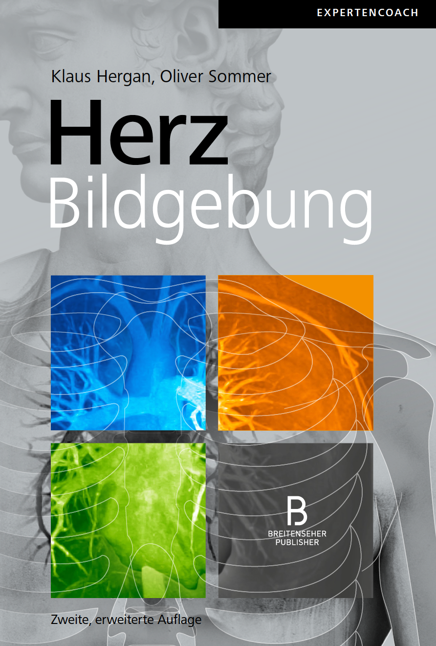 Herzbildgebung 2. Auflage