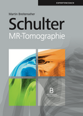 Schulter – MR-Tomographie