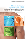 MRI of the Shoulder