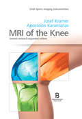 MRI of the Knee, zweite überarbeitete & erweiterte Auflage