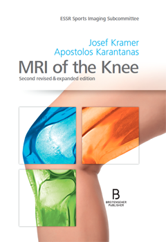MRI of the Knee, zweite überarbeitete & erweiterte Auflage